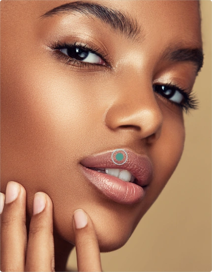 Preenchimento Labial com ácido hialurônico (1ml)